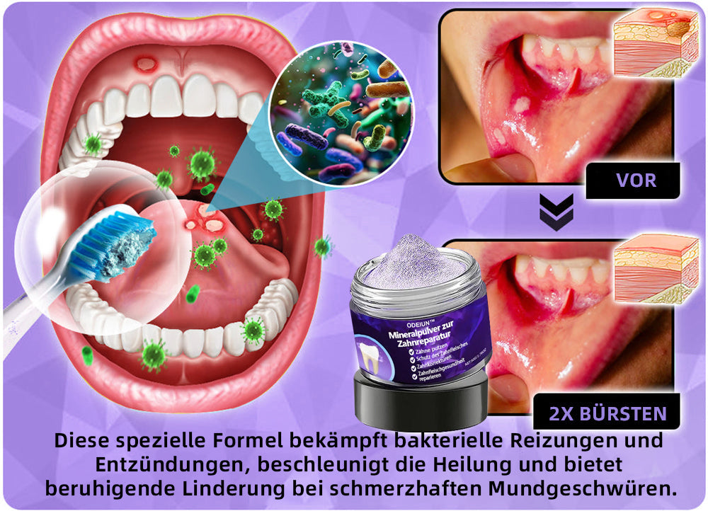Blitzangebot đ â Nicht verpassen! â ODEIUN⢠Mineralpulver zur Zahnreparatur 𦷠(von der BZĂK empfohlen)